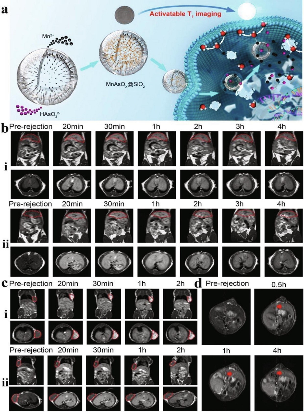 Multifunctional Nanosystems for Precision Oncology: Real-time Monitoring and Controlled Release for Tumor-specific Treatment